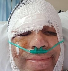 مصدومیت شدید کمدین «خندوانه» در تصادف با اتوبوس 