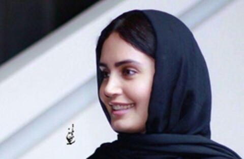ضربه مغزی شدن الناز شاکردوست تکذیب شد