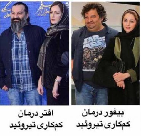 مهراب قاسم خانی قبل و بعد از کم کاری تیروئید | عکس