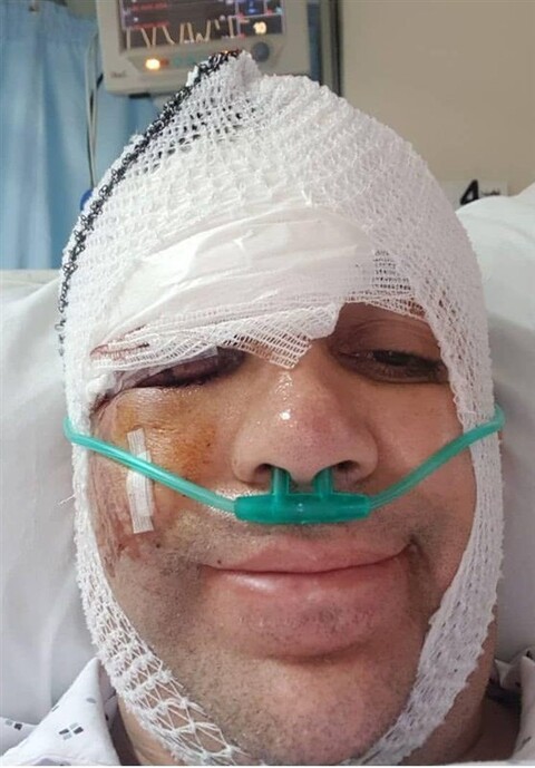 مصدومیت شدید کمدین «خندوانه» در تصادف با اتوبوس 